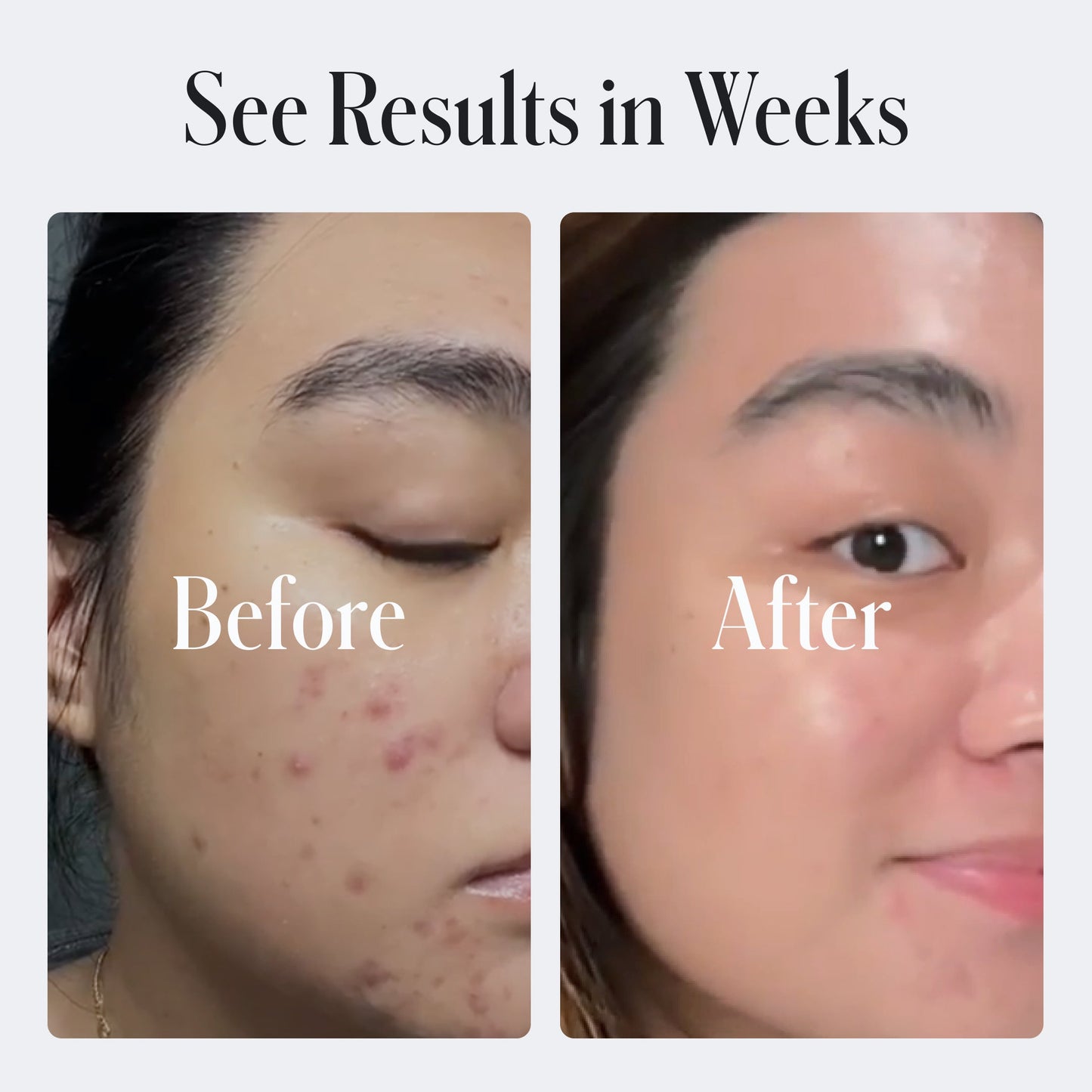 Geologie - Acne Control Body Wash