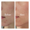 Geologie - Clear System Face Routine