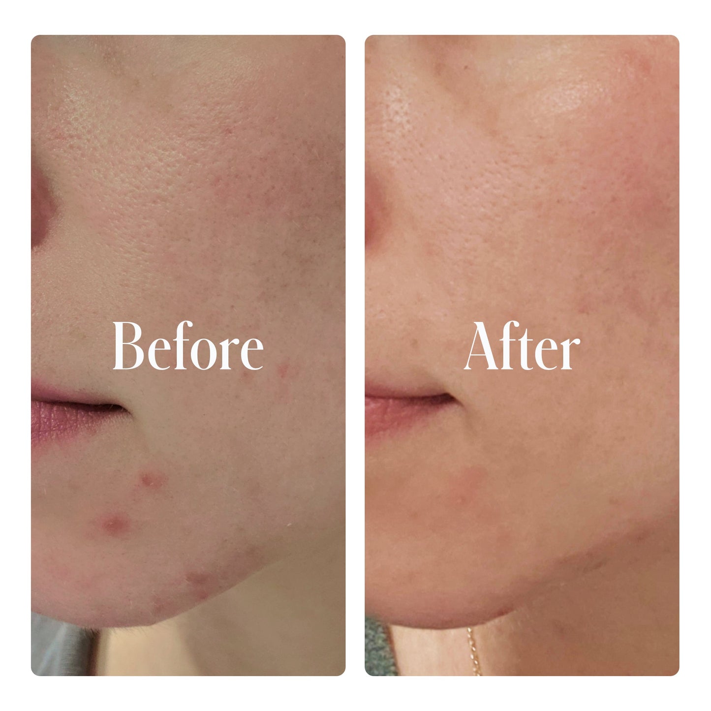 Geologie - Clear System Face Routine